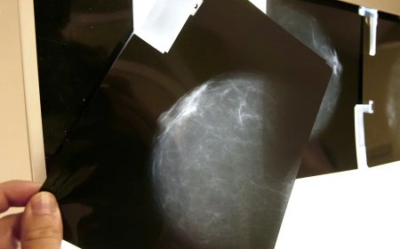 El fallo en el cribado del cáncer de mama en Andalucía obliga a avisar a 2.000 mujeres